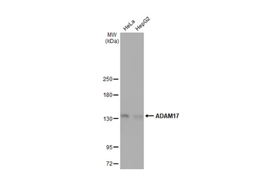 Anti-ADAM17 antibody [HL1572] used in Western Blot (WB). GTX637047