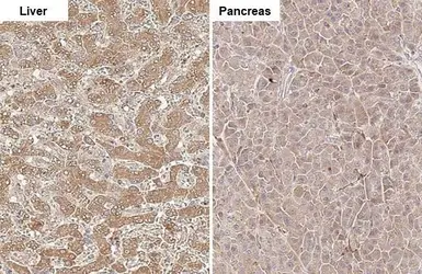 Anti-ADAM17 antibody [HL1572] used in IHC (Paraffin sections) (IHC-P). GTX637047