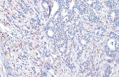 Anti-ADAM17 antibody [HL1572] used in IHC (Paraffin sections) (IHC-P). GTX637047