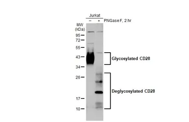 Anti-CD28 antibody [HL1589] used in Western Blot (WB). GTX637068