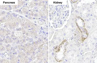 Anti-NDUFV1 antibody [HL1600] used in IHC (Paraffin sections) (IHC-P). GTX637079