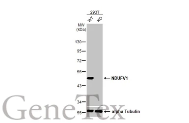 Anti-NDUFV1 antibody [HL1600] used in Western Blot (WB). GTX637079