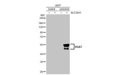 Anti-VGAT antibody [HL1616] used in Western Blot (WB). GTX637107