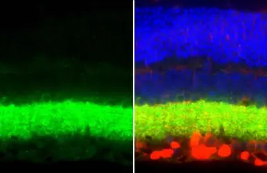 Anti-VGAT antibody [HL1616] used in IHC (Paraffin sections) (IHC-P). GTX637107