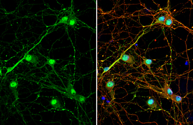 Anti-VGAT antibody [HL1616] used in Immunocytochemistry/ Immunofluorescence (ICC/IF). GTX637107