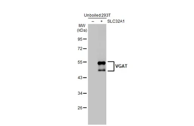 Anti-VGAT antibody [HL1616] used in Western Blot (WB). GTX637107