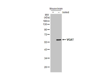 Anti-VGAT antibody [HL1616] used in Western Blot (WB). GTX637107