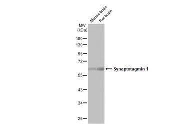 Anti-Synaptotagmin 1 antibody [HL1626] used in Western Blot (WB). GTX637119