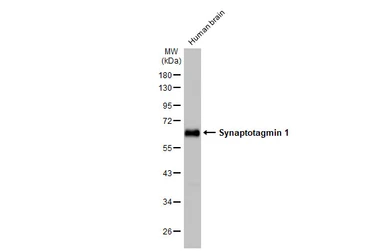 Anti-Synaptotagmin 1 antibody [HL1626] used in Western Blot (WB). GTX637119