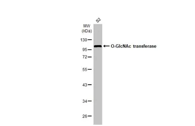 Anti-O-GlcNAc transferase antibody [HL1641] used in Western Blot (WB). GTX637222