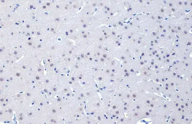 Anti-O-GlcNAc transferase antibody [HL1641] used in IHC (Paraffin sections) (IHC-P). GTX637222