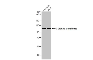 Anti-O-GlcNAc transferase antibody [HL1641] used in Western Blot (WB). GTX637222