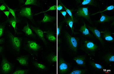 Anti-O-GlcNAc transferase antibody [HL1641] used in Immunocytochemistry/ Immunofluorescence (ICC/IF). GTX637222