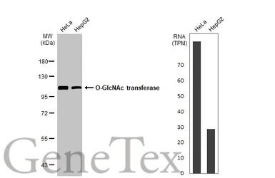 Anti-O-GlcNAc transferase antibody [HL1641] used in Western Blot (WB). GTX637222