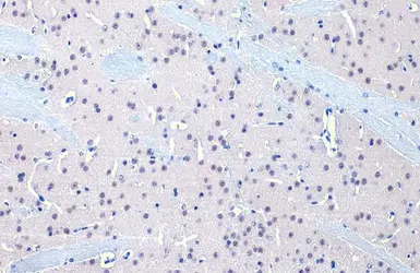 Anti-O-GlcNAc transferase antibody [HL1642] used in IHC (Paraffin sections) (IHC-P). GTX637223