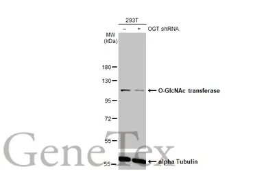 Anti-O-GlcNAc transferase antibody [HL1642] used in Western Blot (WB). GTX637223