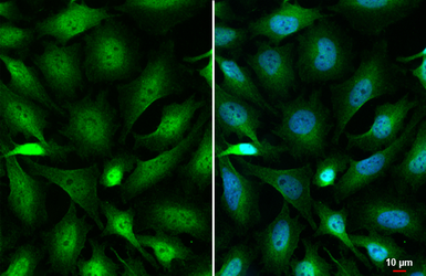 Anti-O-GlcNAc transferase antibody [HL1642] used in Immunocytochemistry/ Immunofluorescence (ICC/IF). GTX637223