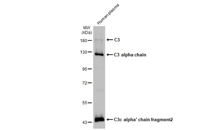 Anti-C3 antibody [HL1643] used in Western Blot (WB). GTX637224