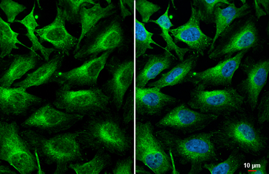 Anti-C3 antibody [HL1643] used in Immunocytochemistry/ Immunofluorescence (ICC/IF). GTX637224