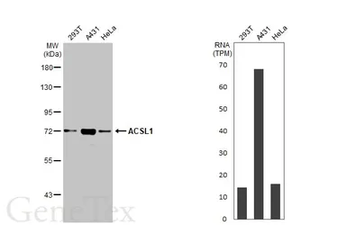 Anti-ACSL1 antibody [HL1651] used in Western Blot (WB). GTX637232