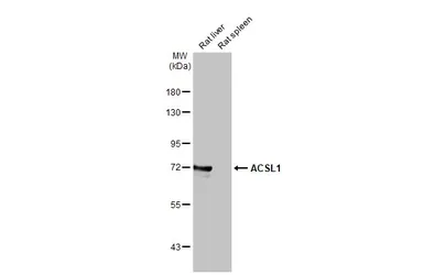 Anti-ACSL1 antibody [HL1651] used in Western Blot (WB). GTX637232