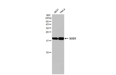 Anti-SOD1 antibody [HL1653] used in Western Blot (WB). GTX637251