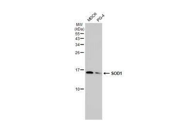 Anti-SOD1 antibody [HL1653] used in Western Blot (WB). GTX637251