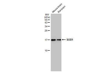 Anti-SOD1 antibody [HL1653] used in Western Blot (WB). GTX637251