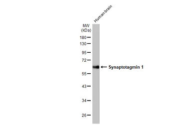 Anti-Synaptotagmin 1 antibody [HL1654] used in Western Blot (WB). GTX637252