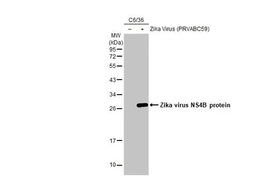 Anti-Zika virus NS4B protein antibody [HL1663] used in Western Blot (WB). GTX637261