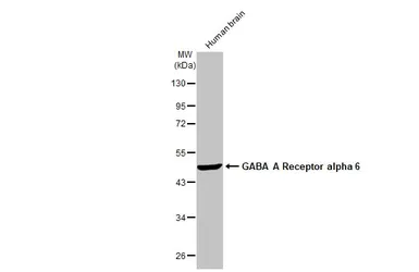 Anti-GABA A Receptor alpha 6 antibody [HL1669] used in Western Blot (WB). GTX637268