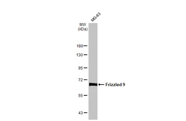 Anti-Frizzled 9 antibody [HL1675] used in Western Blot (WB). GTX637274