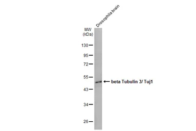 Anti-beta Tubulin 3/ Tuj1 antibody [HL1709] used in Western Blot (WB). GTX637308