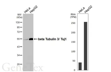 Anti-beta Tubulin 3/ Tuj1 antibody [HL1709] used in Western Blot (WB). GTX637308