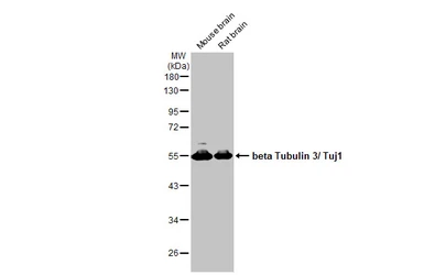 Anti-beta Tubulin 3/ Tuj1 antibody [HL1709] used in Western Blot (WB). GTX637308