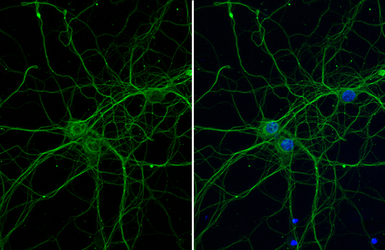 Anti-beta Tubulin 3/ Tuj1 antibody [HL1709] used in Immunocytochemistry/ Immunofluorescence (ICC/IF). GTX637308