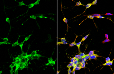 Anti-beta Tubulin 3/ Tuj1 antibody [HL1709] used in Immunocytochemistry/ Immunofluorescence (ICC/IF). GTX637308