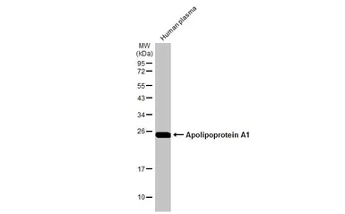 Anti-Apolipoprotein A1 antibody [HL1713] used in Western Blot (WB). GTX637312