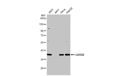 Anti-LASS2 antibody [HL1717] used in Western Blot (WB). GTX637316