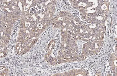 Anti-LASS2 antibody [HL1717] used in IHC (Paraffin sections) (IHC-P). GTX637316