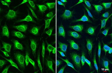 Anti-LASS2 antibody [HL1717] used in Immunocytochemistry/ Immunofluorescence (ICC/IF). GTX637316