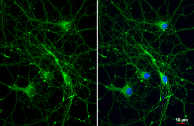 Anti-Bassoon antibody [HL1732] used in Immunocytochemistry/ Immunofluorescence (ICC/IF). GTX637380