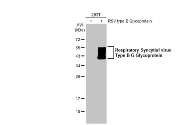 Anti-Respiratory Syncytial virus type B G protein antibody [HL1733] used in Western Blot (WB). GTX637381