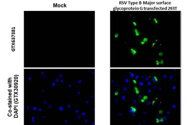 Anti-Respiratory Syncytial virus type B G protein antibody [HL1733] used in IHC-P (cell pellet) (IHC-P (cell pellet)). GTX637381