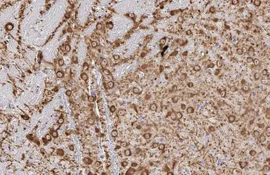 Anti-Tyrosine Hydroxylase antibody [HL1762] used in IHC (Paraffin sections) (IHC-P). GTX637412