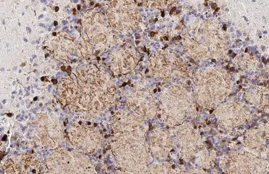 Anti-Tyrosine Hydroxylase antibody [HL1762] used in IHC (Paraffin sections) (IHC-P). GTX637412