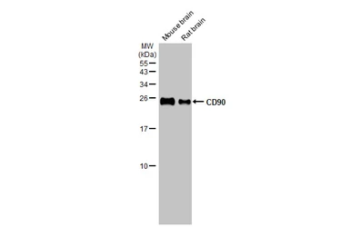 Anti-CD90 antibody [HL1766] used in Western Blot (WB). GTX637416