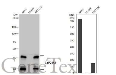 Anti-CYP24A1 antibody [HL1783] used in Western Blot (WB). GTX637435