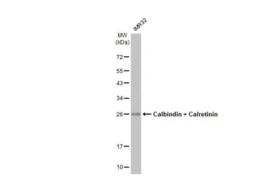 Anti-Calbindin + Calretinin antibody [HL1787] used in Western Blot (WB). GTX637439