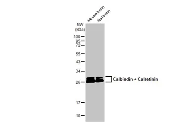 Anti-Calbindin + Calretinin antibody [HL1787] used in Western Blot (WB). GTX637439